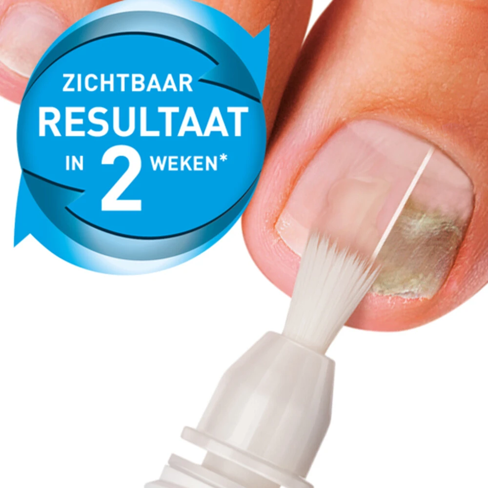 Mycosan Kalknagel Met Voet En Schoenpoeder Pakket 2 Mycosan Kalknagel Met Voet En Schoenpoeder Pakket - Afbeelding 2